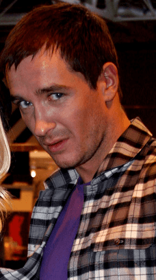 Anthony Quinlan - Actor with unconfirmed hair transplant