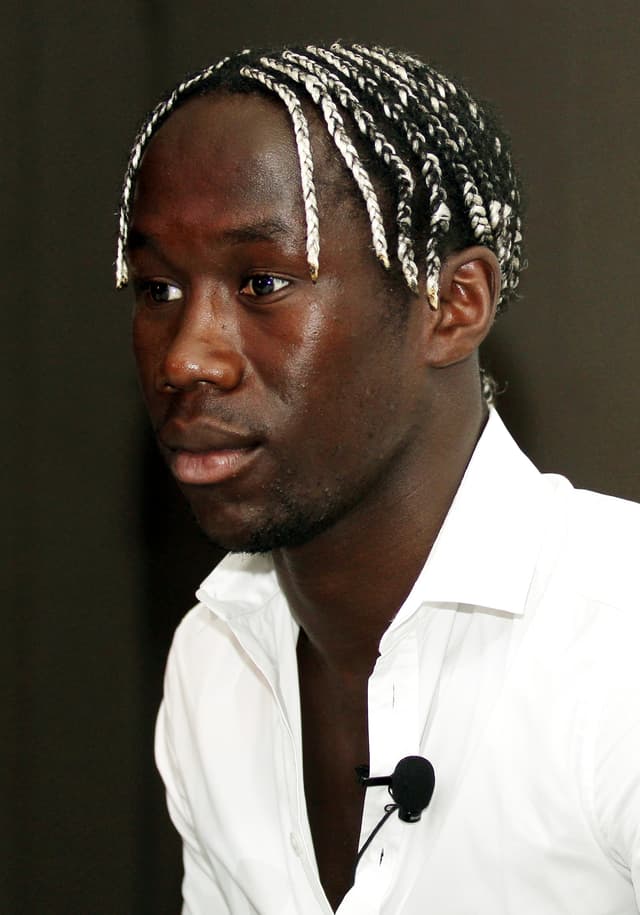 Bacary Sagna - Athlete with unconfirmed hair transplant