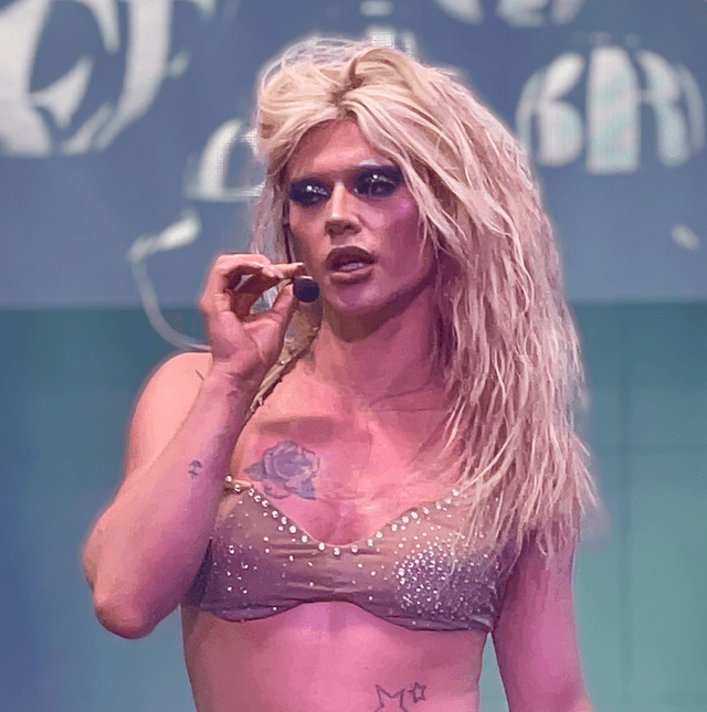 Bimini Bon Boulash - TV Personality with unconfirmed hair transplant