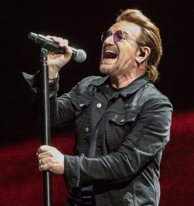 Bono - Musician with unconfirmed hair transplant
