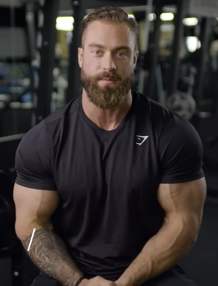 Chris Bumstead - Entrepreneur with confirmed hair transplant