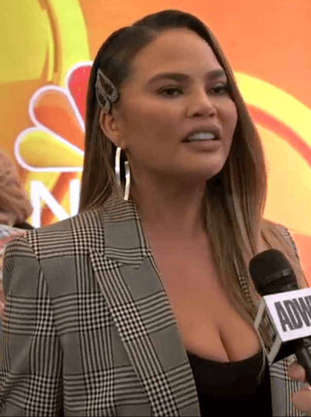 Chrissy Teigen - TV Personality with unconfirmed hair transplant