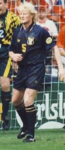 Colin Hendry - Athlete with unconfirmed hair transplant