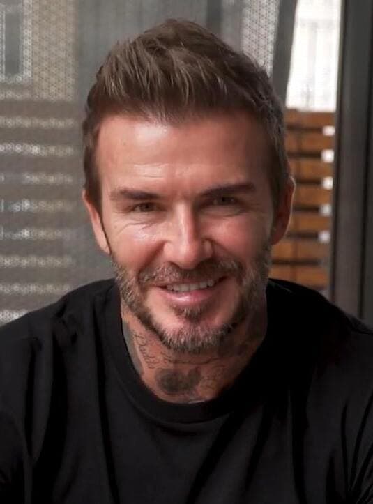 David Beckham - Athlete hair transplant