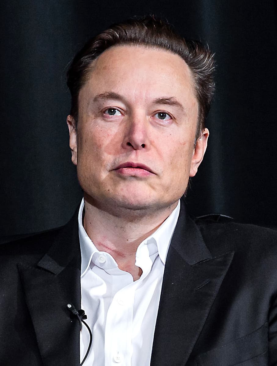 Elon Musk - Entrepreneur hair transplant