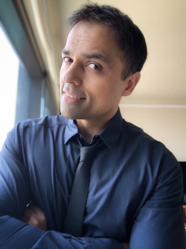 Gurbaksh Chahal - Entrepreneur with unconfirmed hair transplant