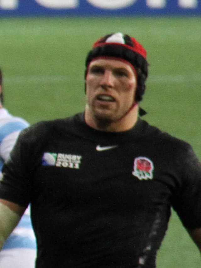 James Haskell - Athlete with unconfirmed hair transplant