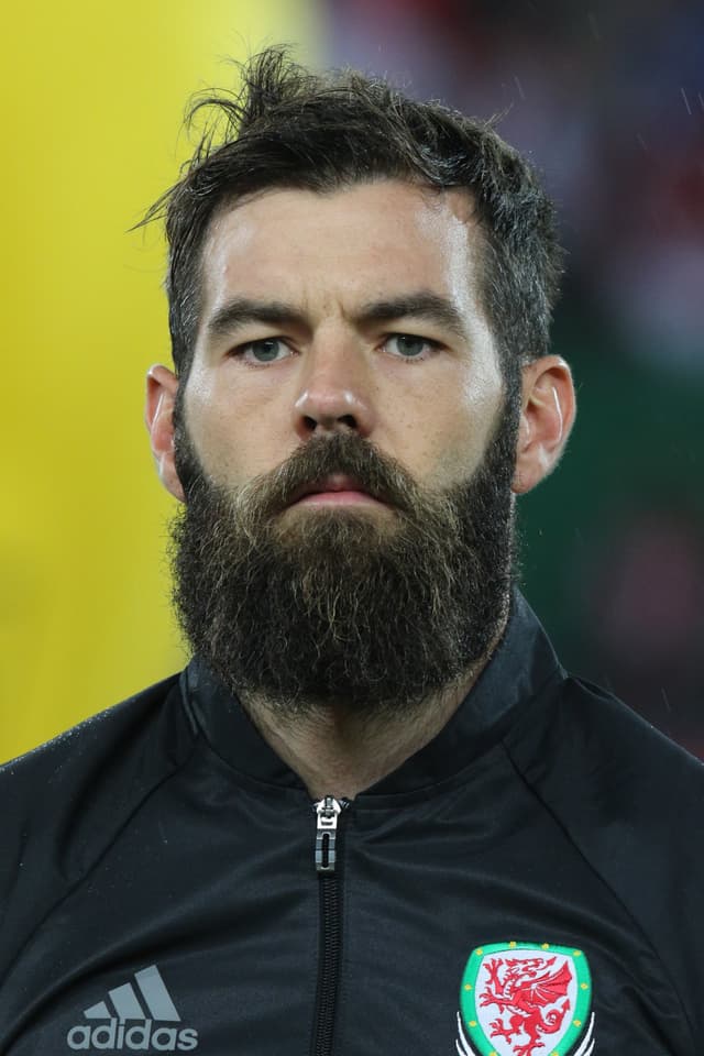 Joe Ledley - Athlete with unconfirmed hair transplant
