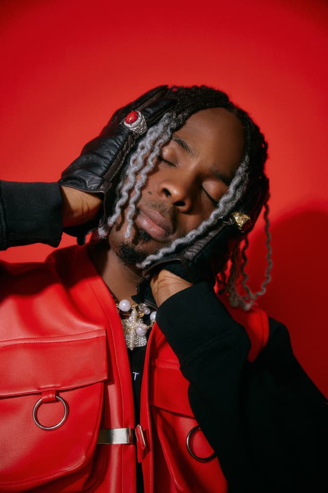 John Saviours Udomboso aka Young Jonn - Musician with unconfirmed hair transplant