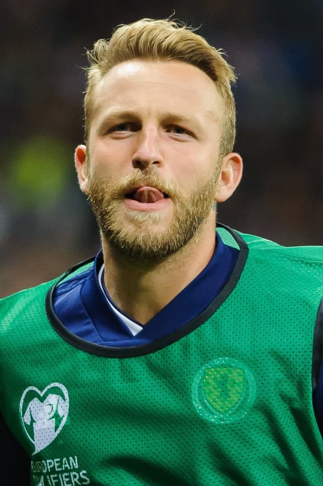 Johnny Russell - Athlete with unconfirmed hair transplant