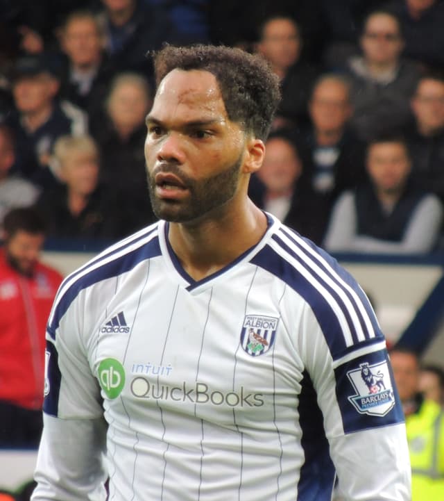 Joleon Lescott - Athlete with unconfirmed hair transplant