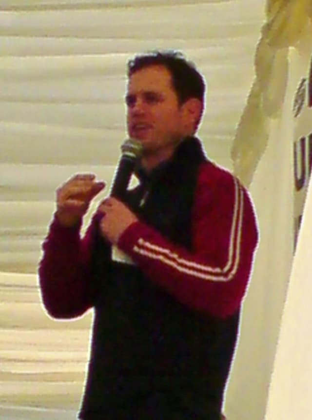 Kyran Bracken - Athlete with unconfirmed hair transplant