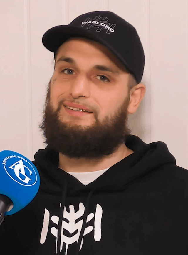 Liam Cameron - Athlete with unconfirmed hair transplant