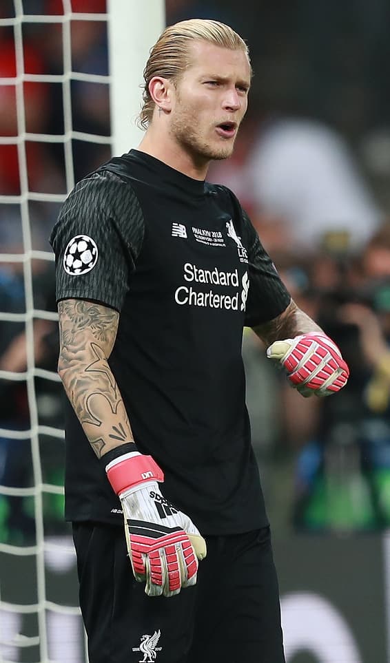 Loris Karius - Athlete with unconfirmed hair transplant
