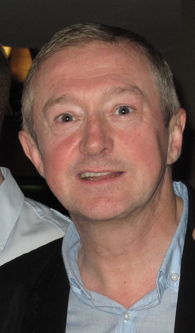 Louis Walsh - TV Personality with confirmed hair transplant
