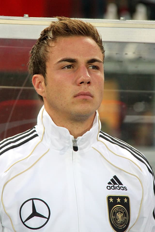 Mario Gotze - Athlete with unconfirmed hair transplant