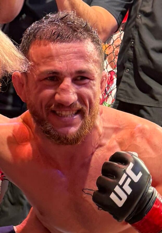 Merab Dvalishvili - Athlete with unconfirmed hair transplant