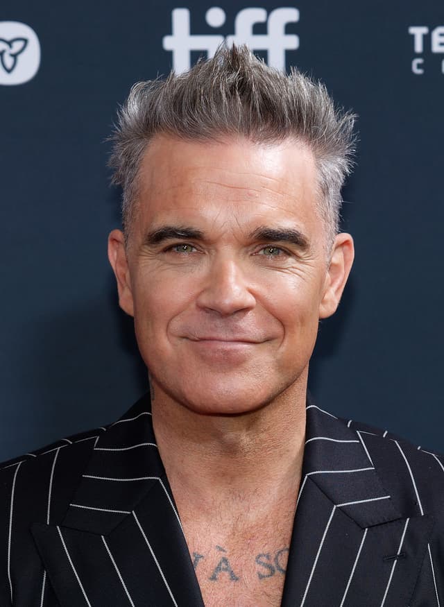 Robbie Williams - Musician with confirmed hair transplant
