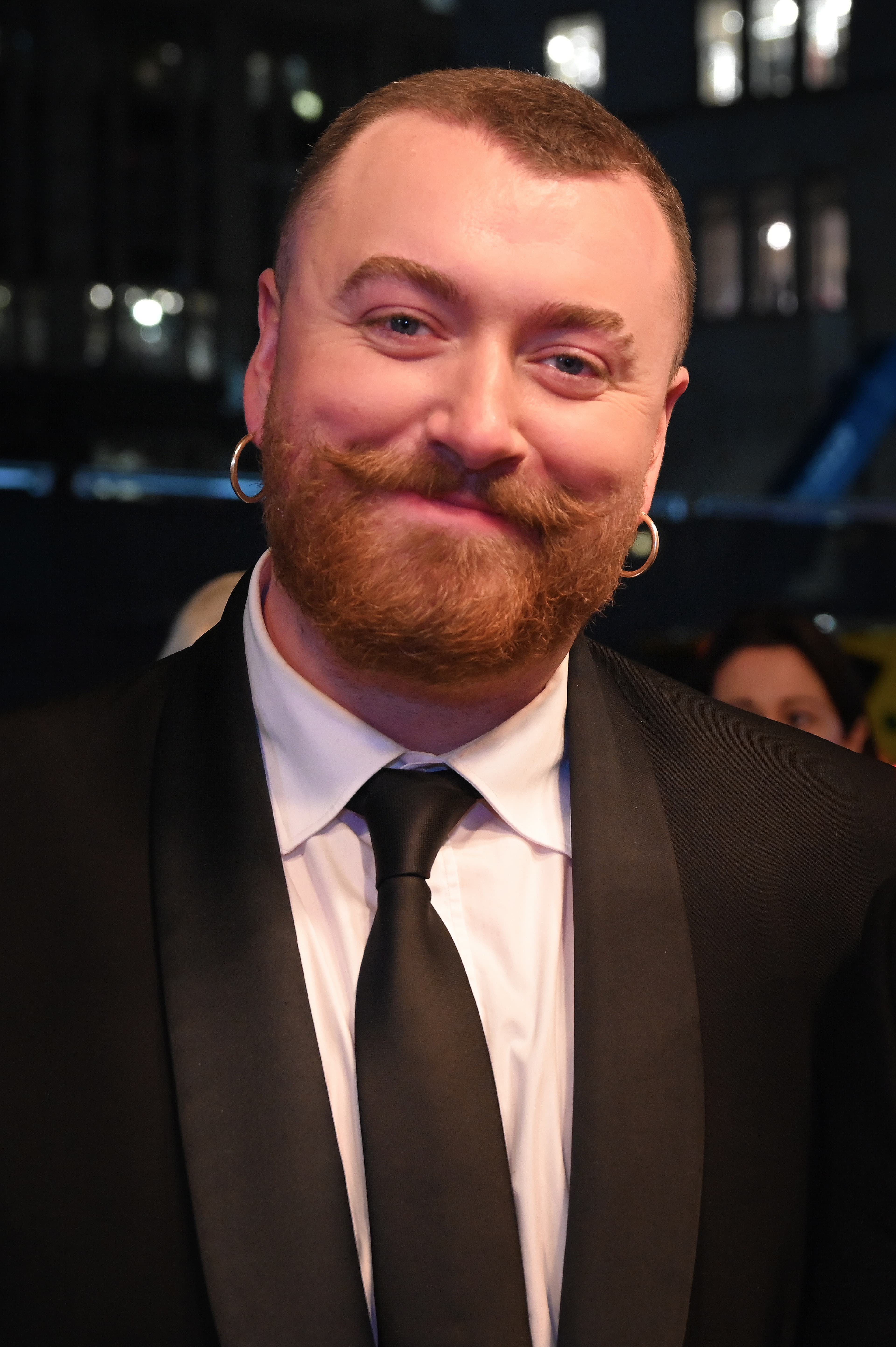 Sam Smith - Musician with confirmed hair transplant