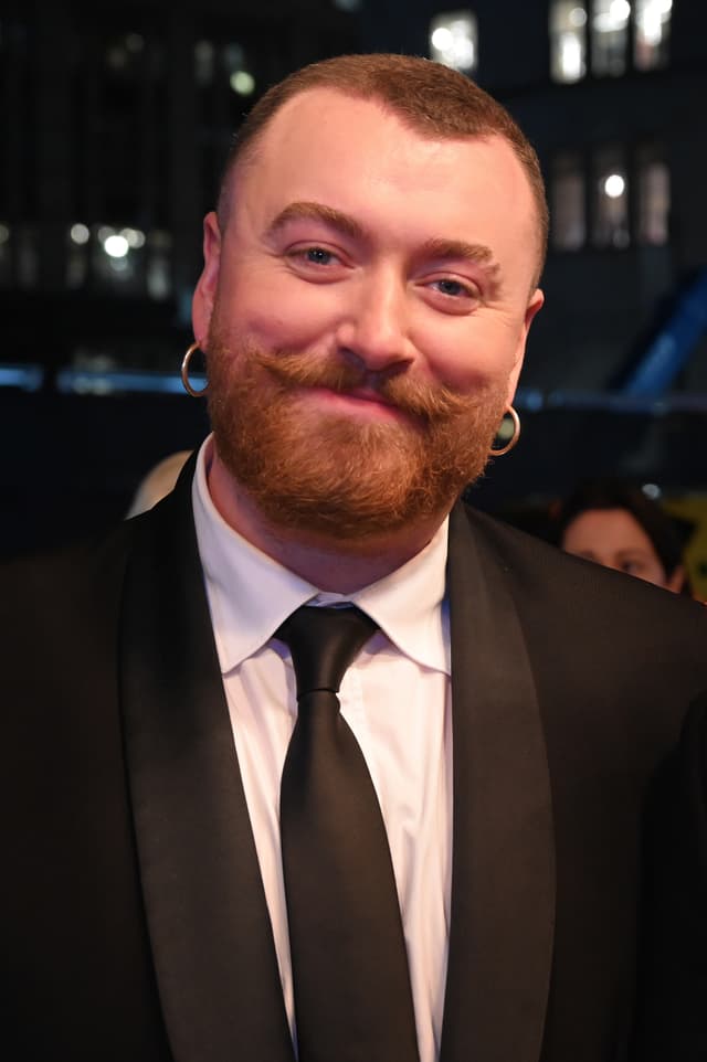 Sam Smith - Musician with confirmed hair transplant