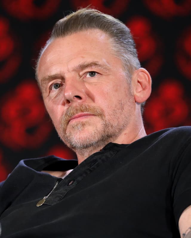 Simon Pegg - Actor with unconfirmed hair transplant