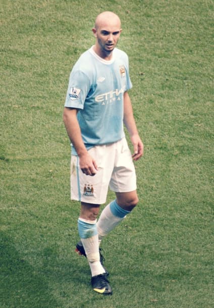 Stephen Ireland - Athlete with unconfirmed hair transplant