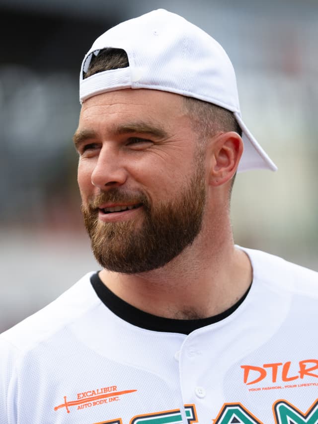 Travis Kelce - Athlete with unconfirmed hair transplant