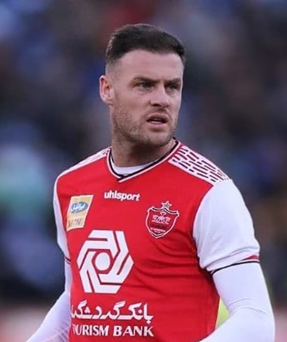 Anthony Stokes - Athlete with confirmed hair transplant