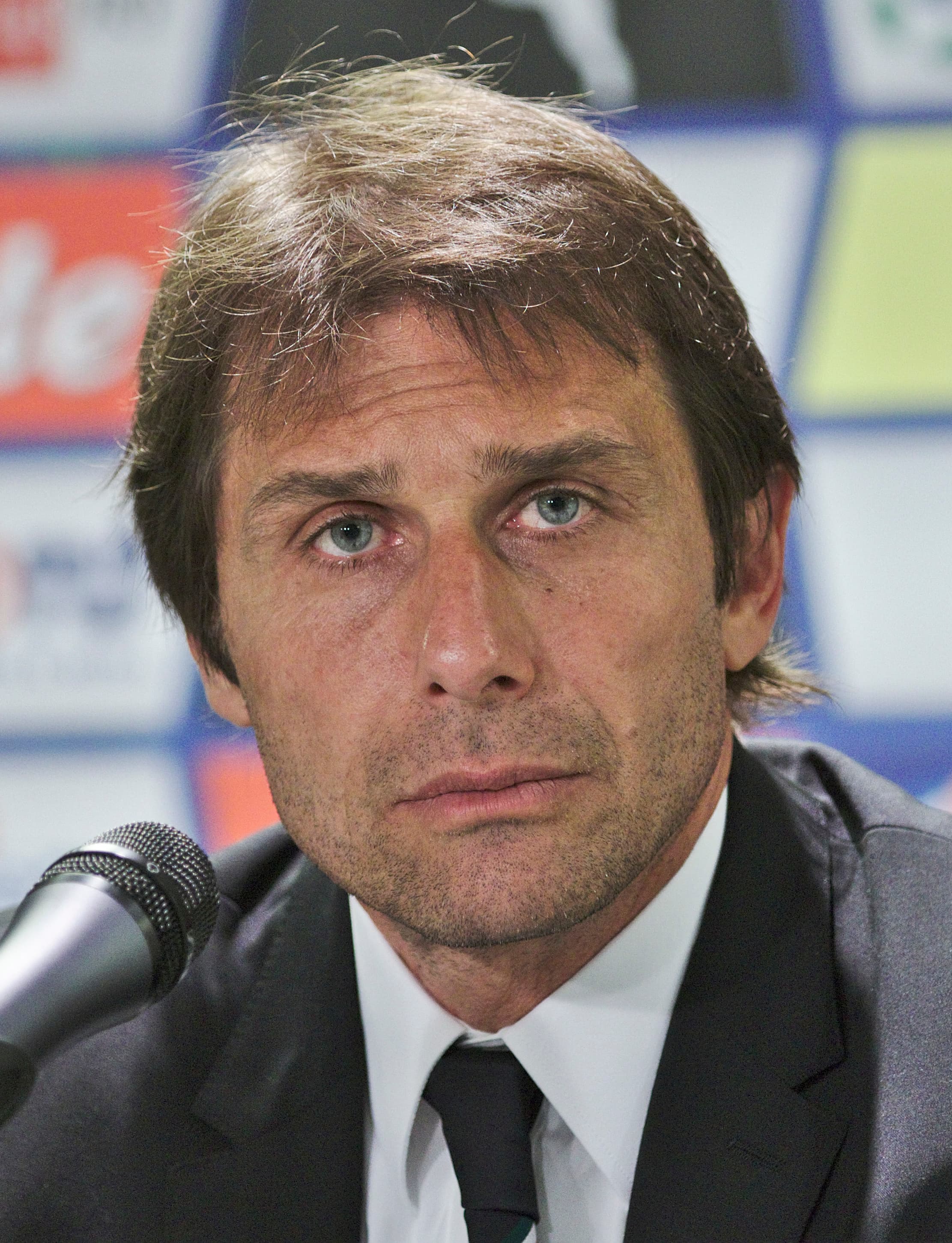 Antonio Conte - Athlete hair transplant
