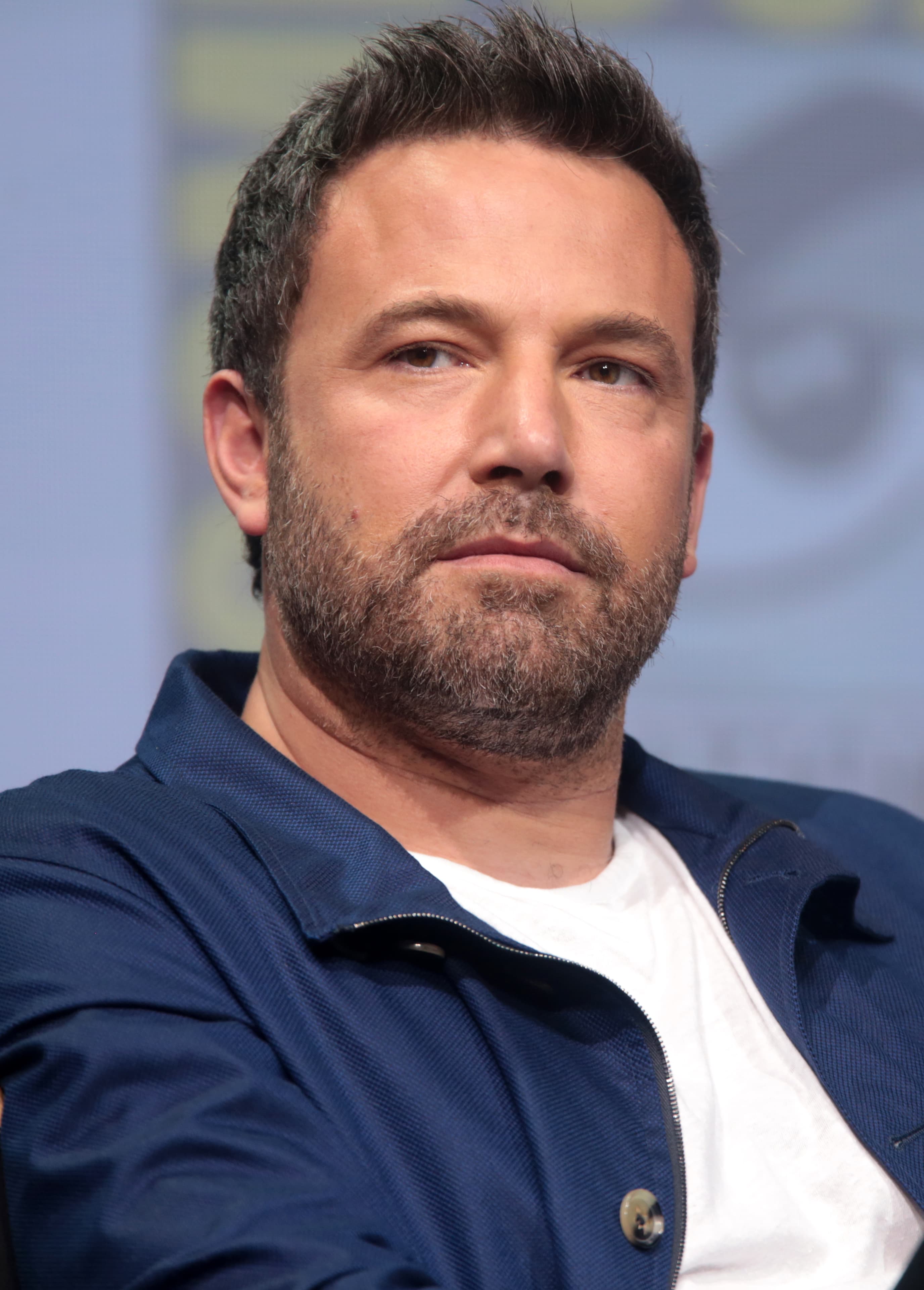 Ben Affleck - Actor hair transplant