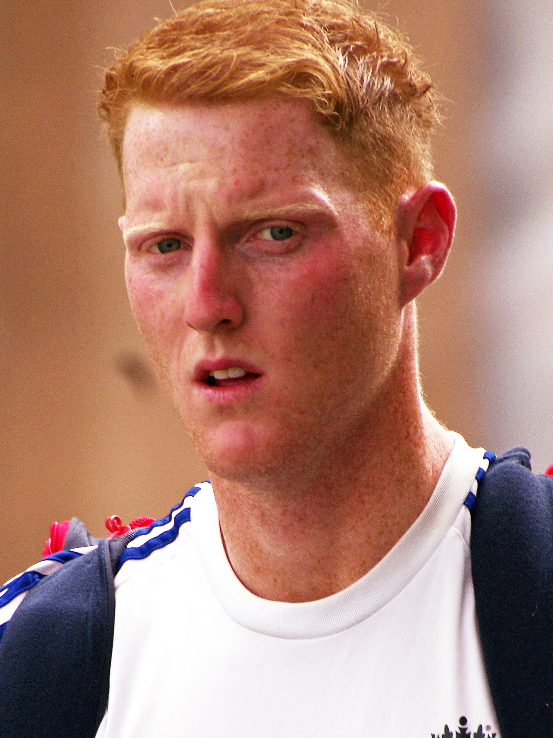 Ben Stokes - Athlete with confirmed hair transplant