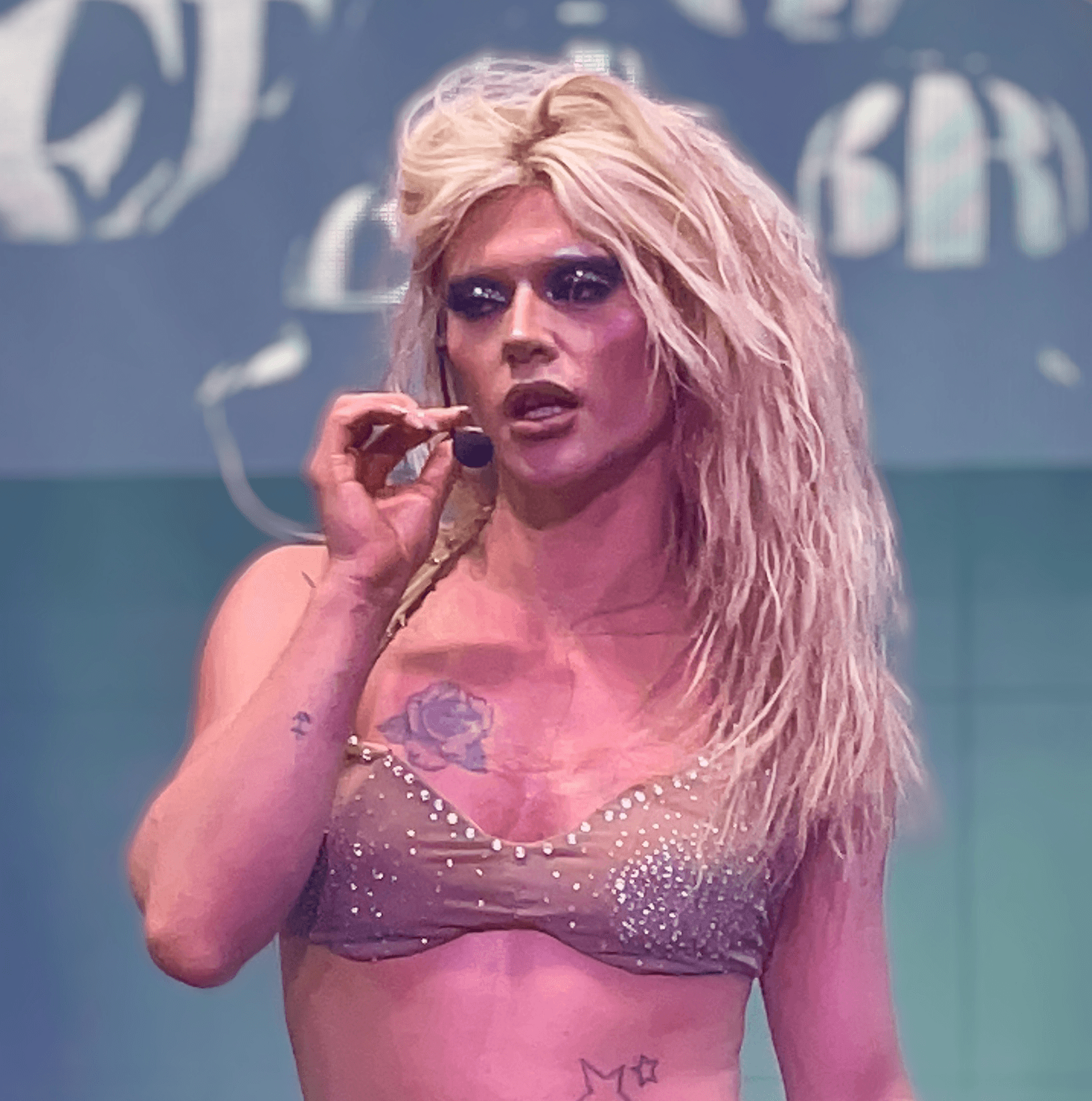 Bimini Bon Boulash - TV Personality hair transplant