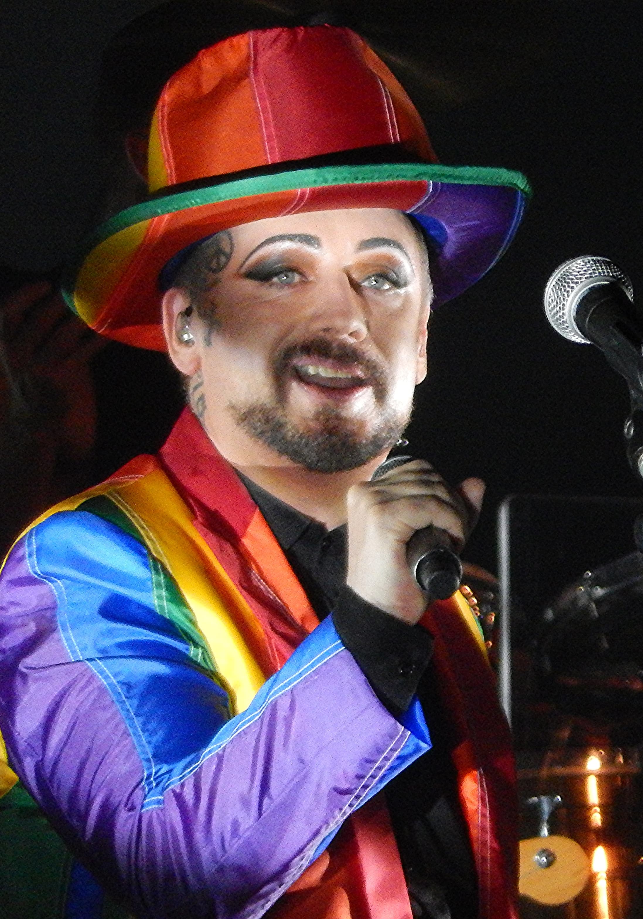 Boy George - Musician hair transplant