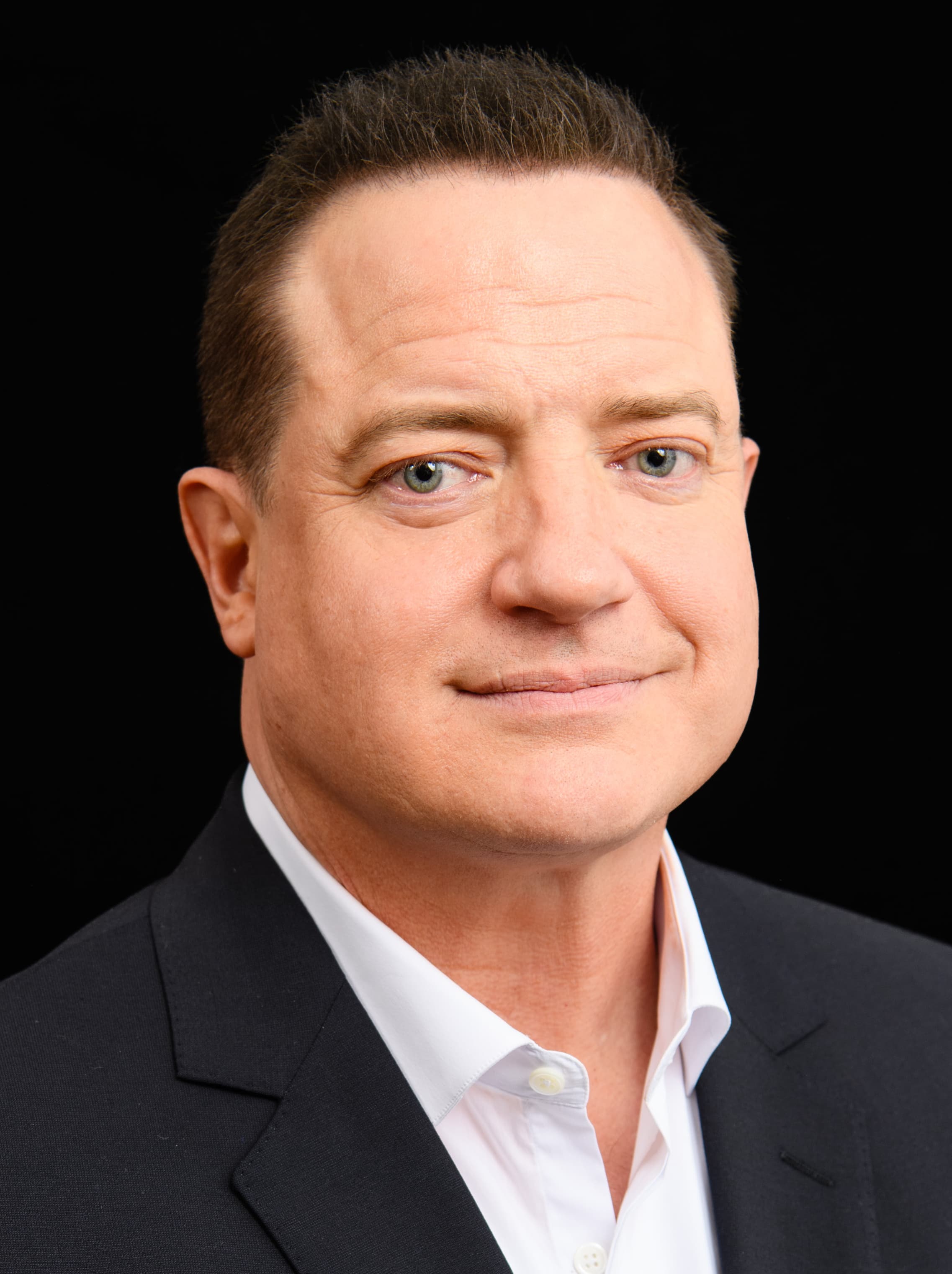 Brendan Fraser - Actor hair transplant