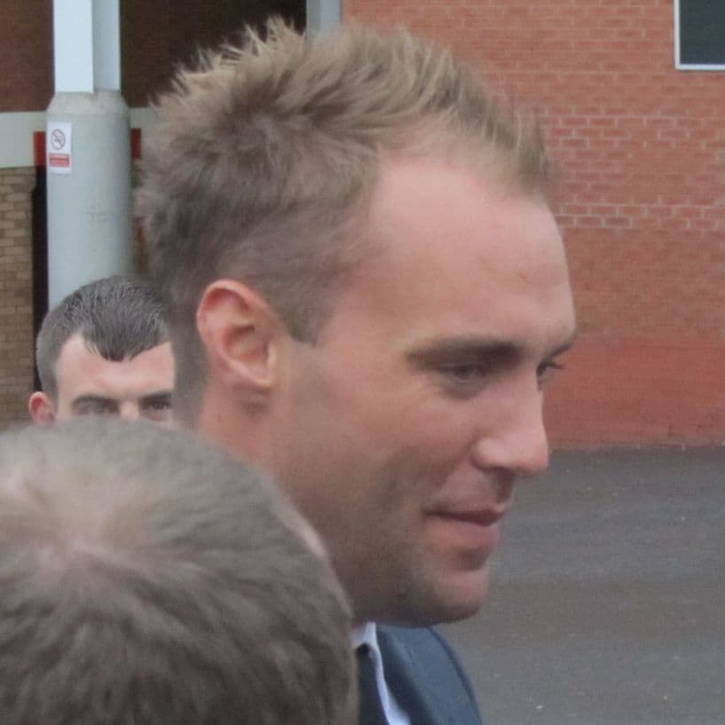 Calum Best - TV Personality with confirmed hair transplant