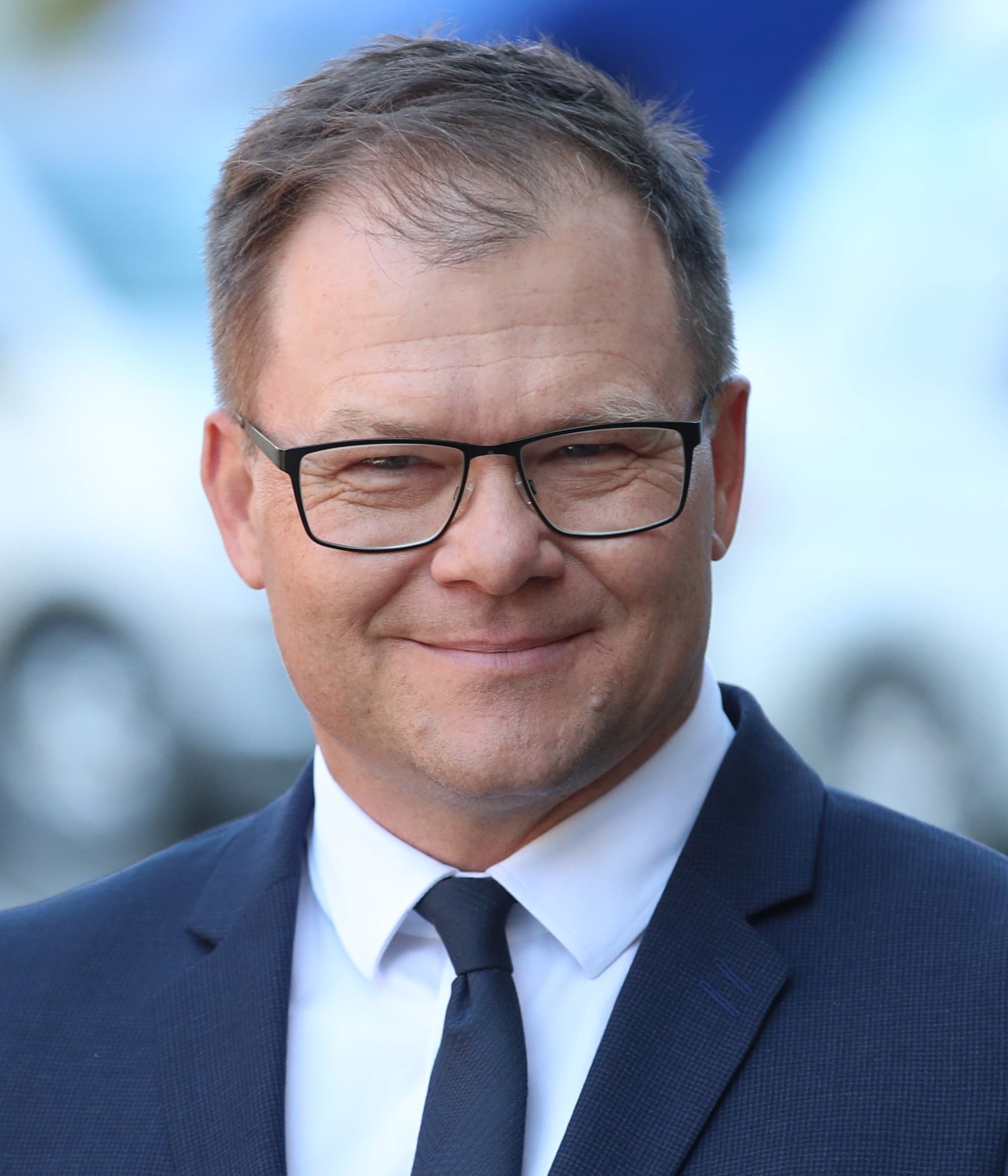 Carsten Schneider - Public Figure hair transplant