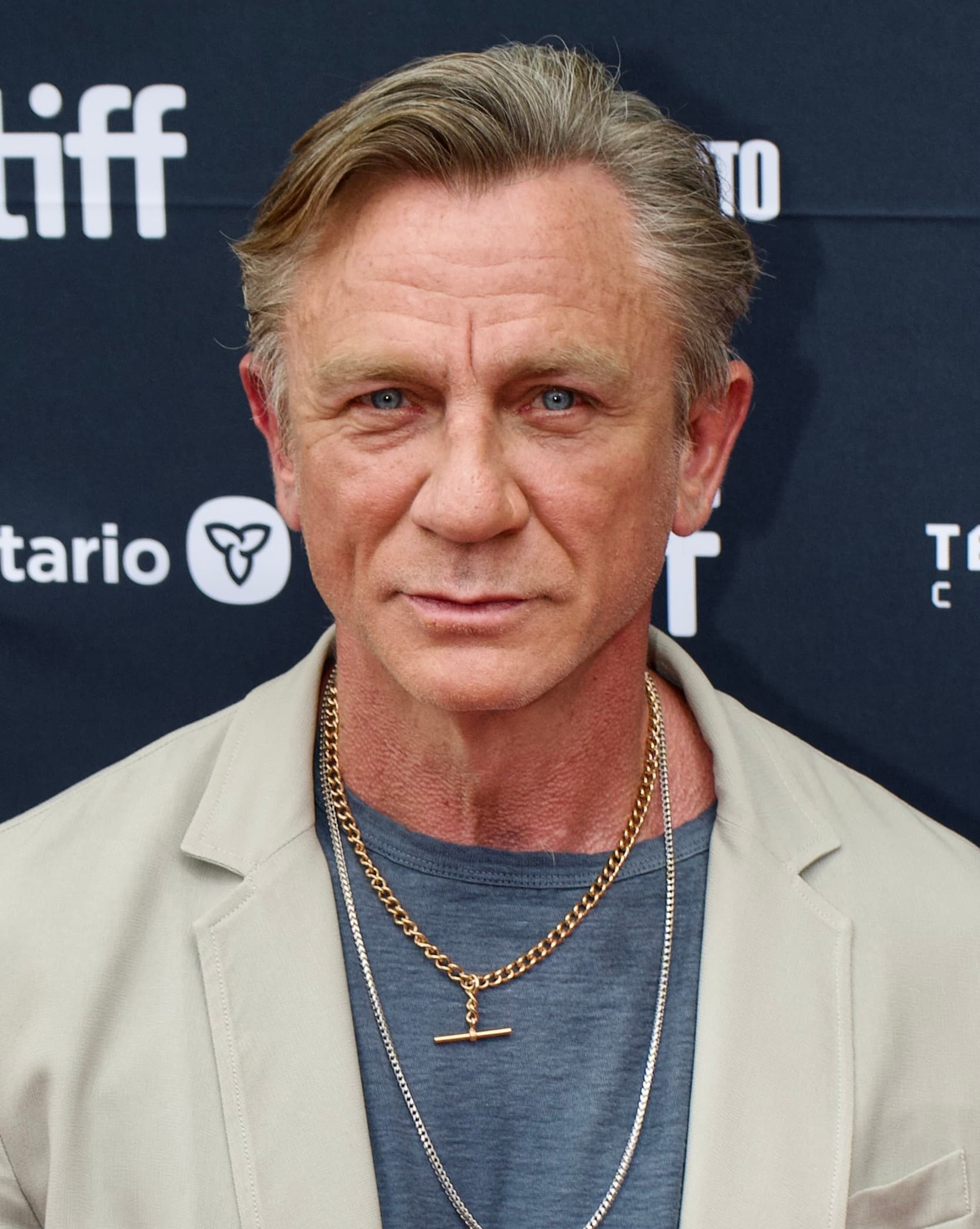 Daniel Craig - Actor hair transplant