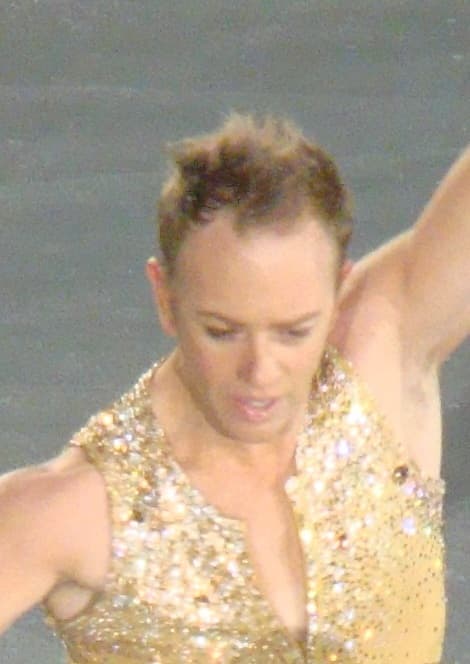 Daniel Whiston - Athlete hair transplant