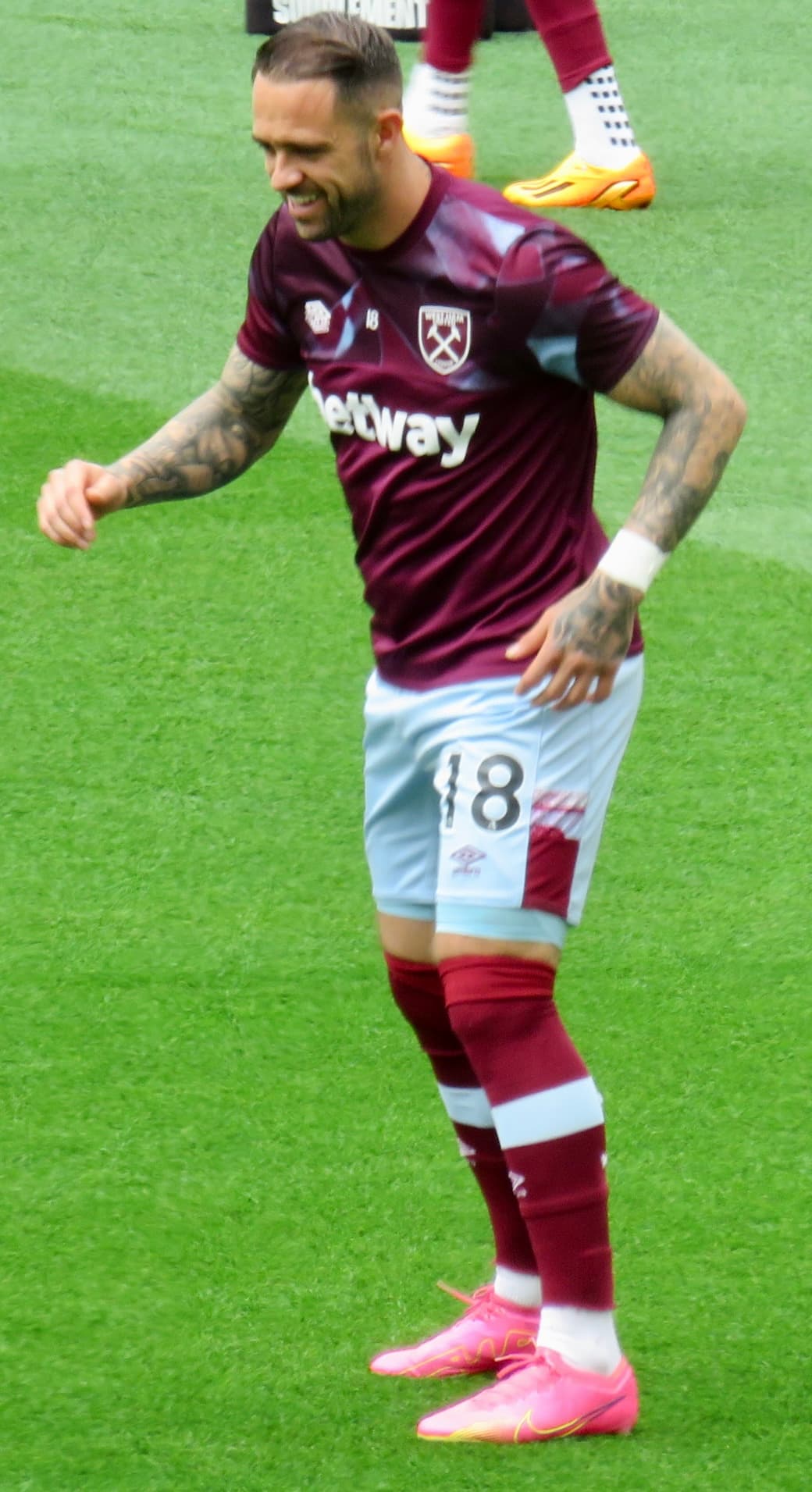 Danny Ings - Athlete with confirmed hair transplant