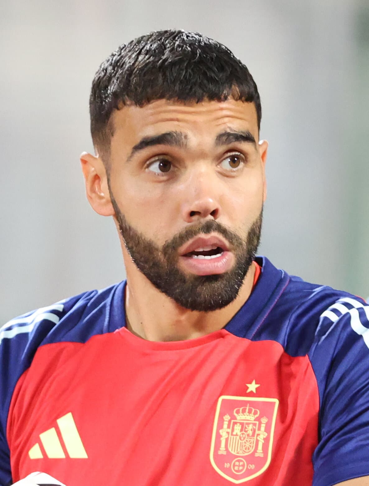 David Raya - Athlete hair transplant