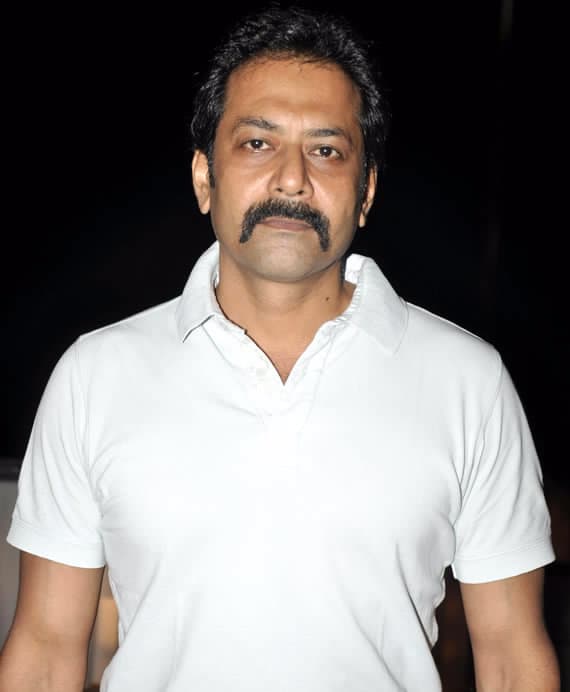 Deep Raj Rana - Actor hair transplant