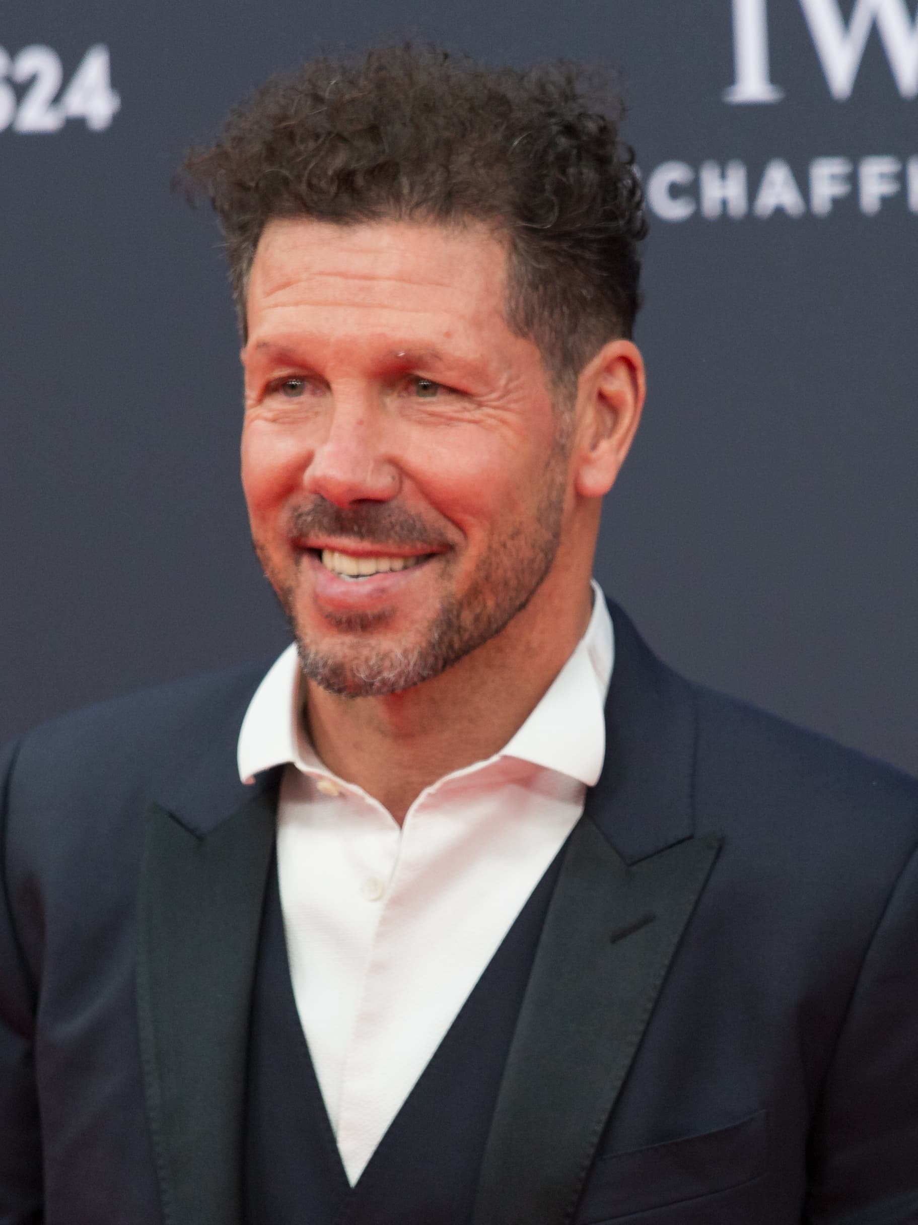 Diego Simeone - Athlete hair transplant