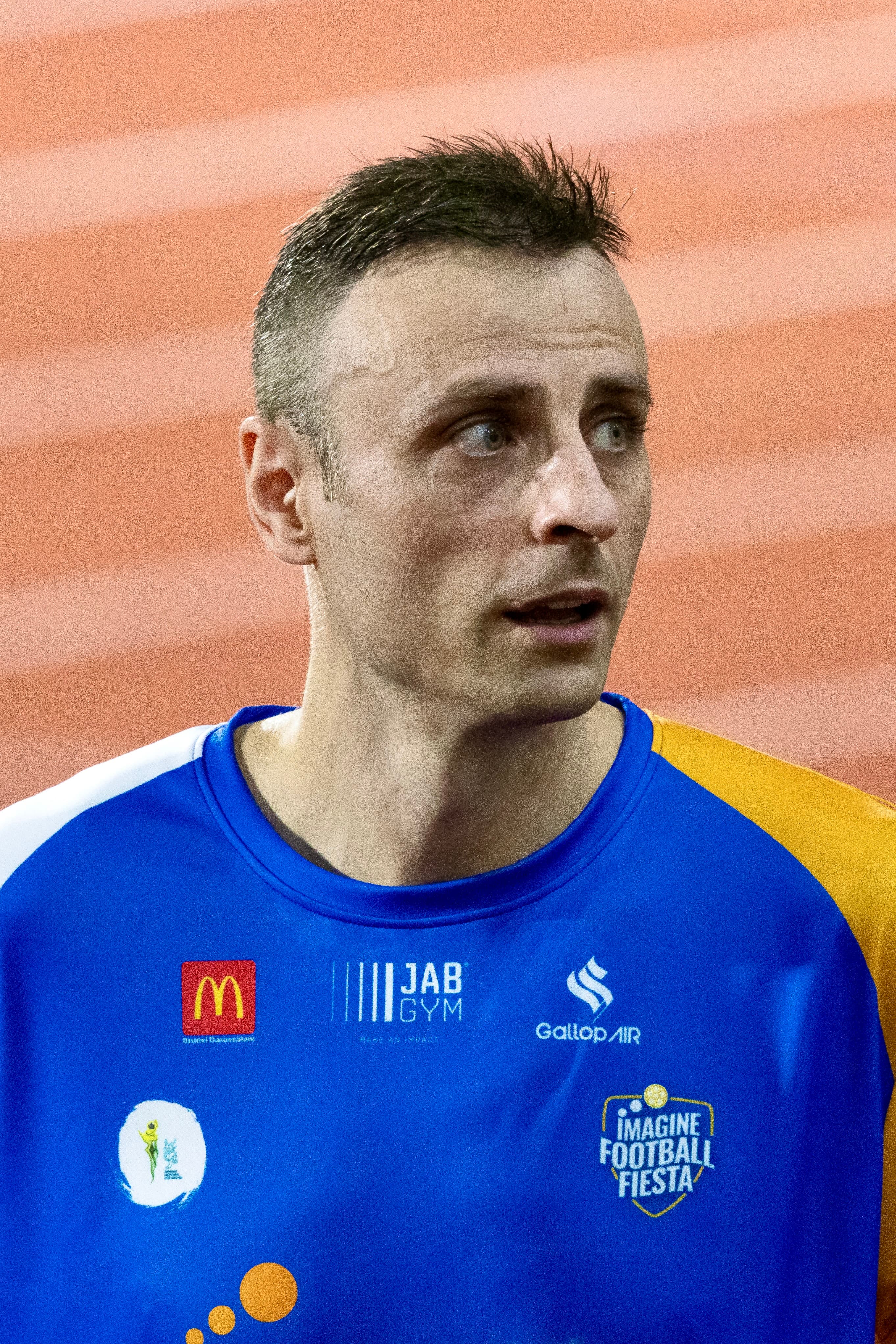 Dimitar Berbatov - Athlete hair transplant