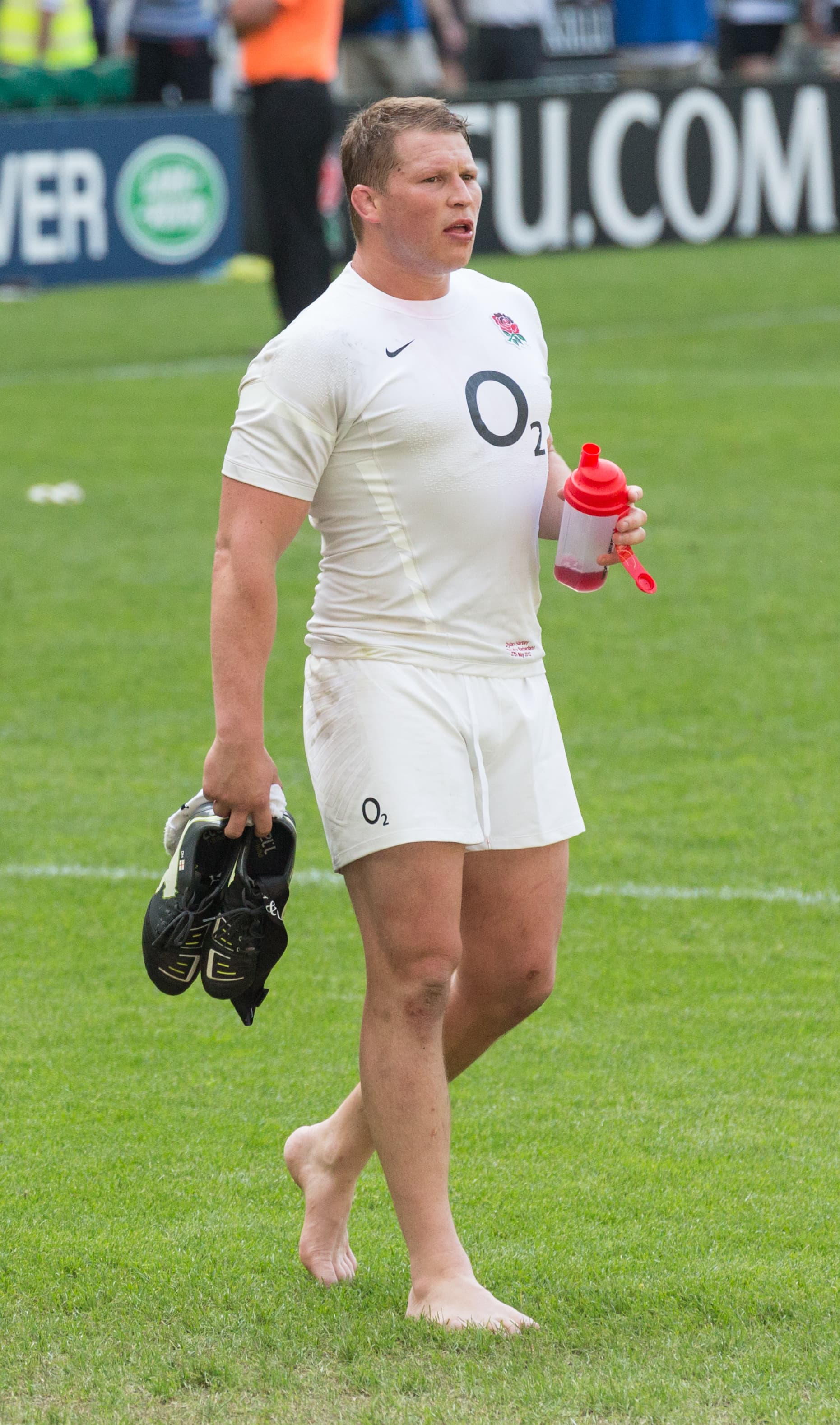 Dylan Hartley - Athlete hair transplant
