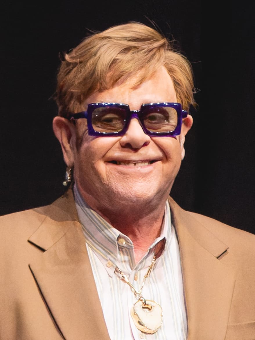 Elton John - Musician with confirmed hair transplant