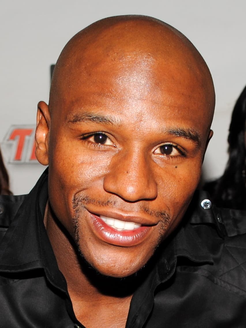 Floyd Mayweather - Athlete hair transplant