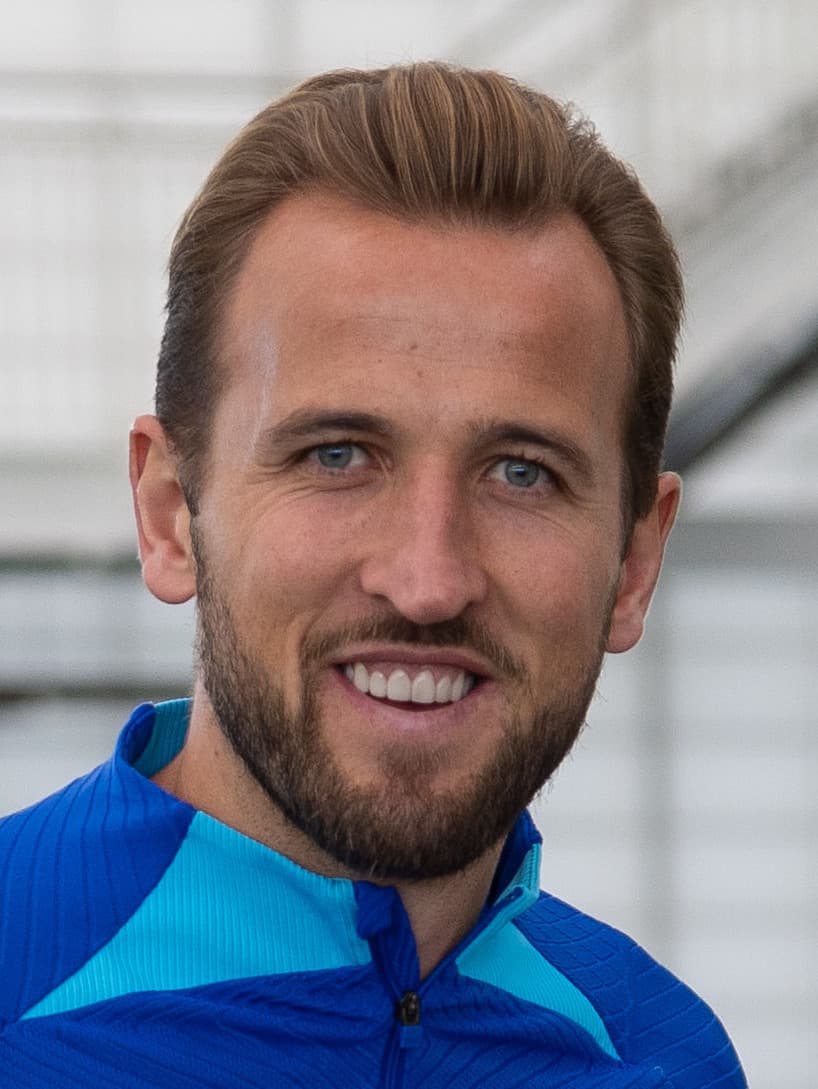 Harry Kane - Athlete hair transplant