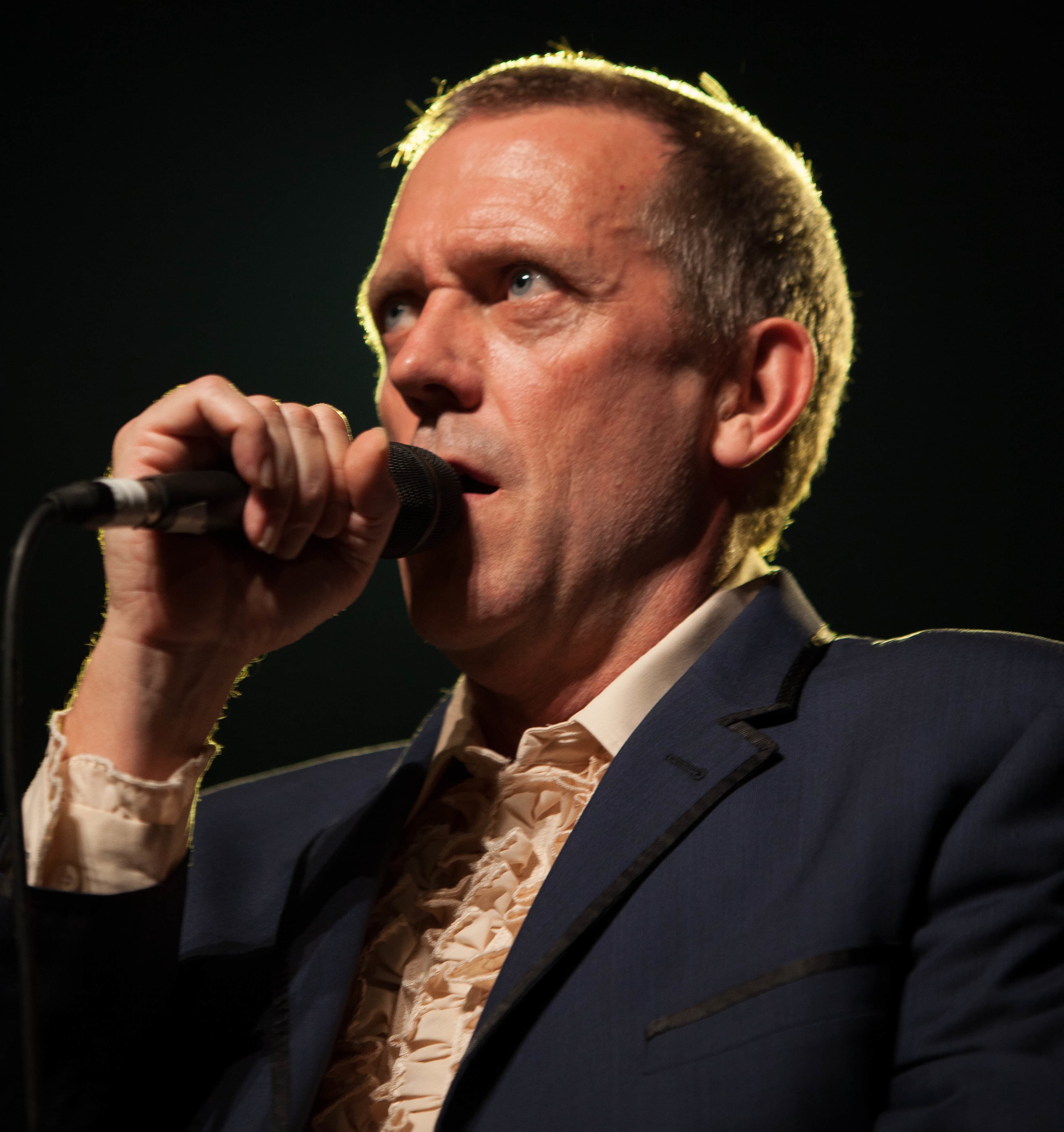 Hugh Laurie - Actor hair transplant