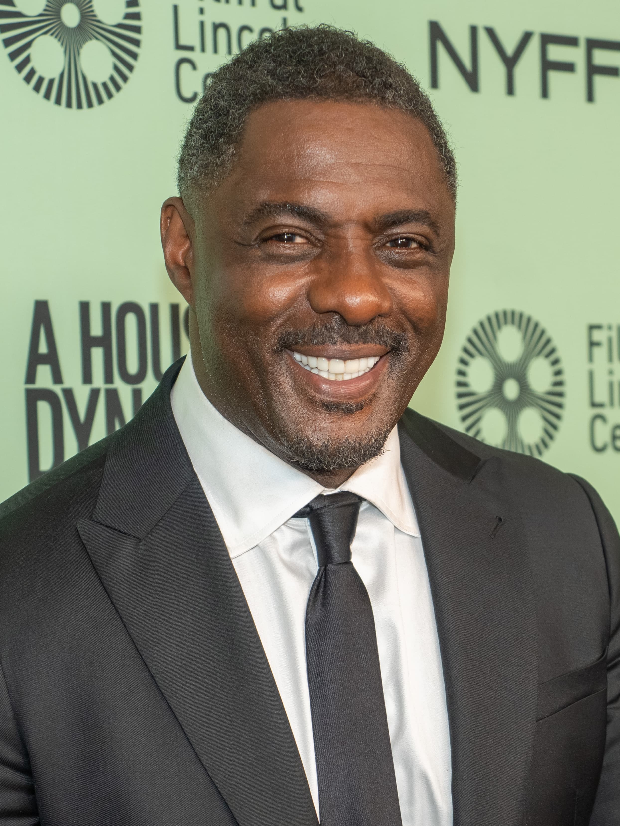 Idris Elba - Actor hair transplant