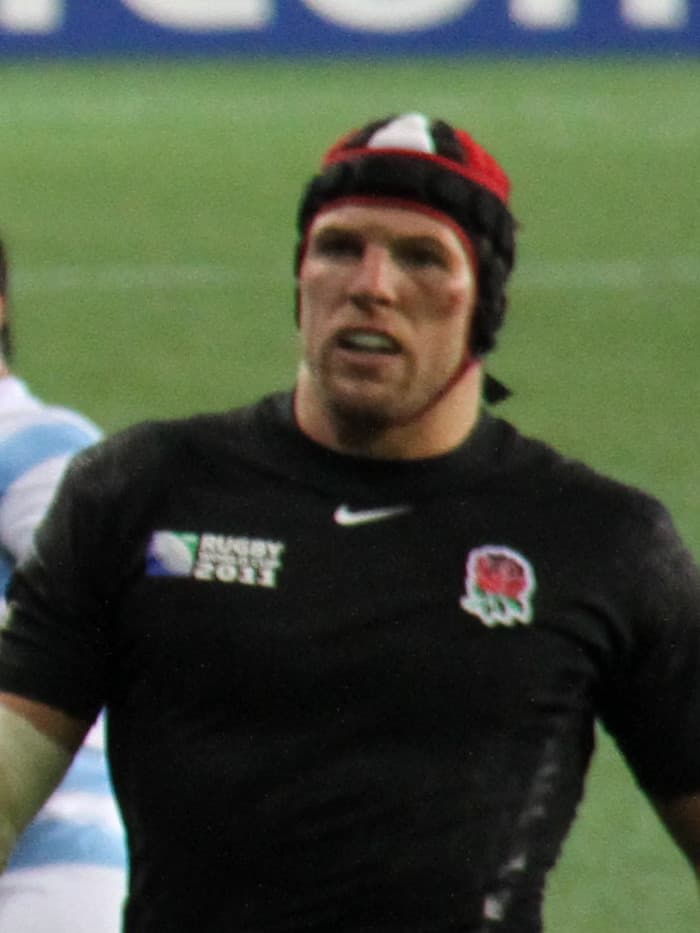 James Haskell - Athlete hair transplant